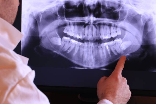 Best Broken Tooth Emergency  in Bothell West, WA