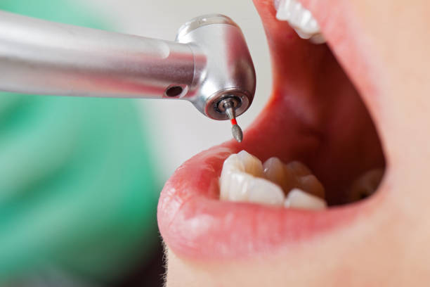 Best Knocked-Out Tooth Emergency  in Bothell West, WA